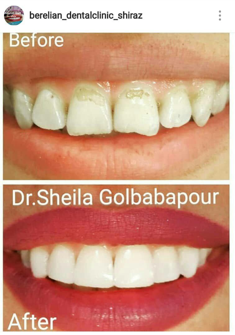 کلینیک دندانپزشکی برلیان شیراز دکتر شیلا گلباباپور
