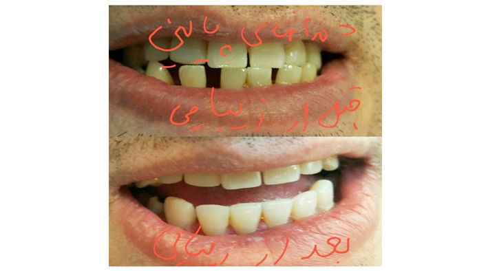 دندانپزشک اردبیل-دندانپزشک خوب اردبیل-دکتر عبداله بهمنی