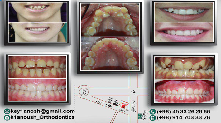 متخصص ارتودنسی اردبیل-دندانپزشک اردبیل-دکتر کیوان انوش