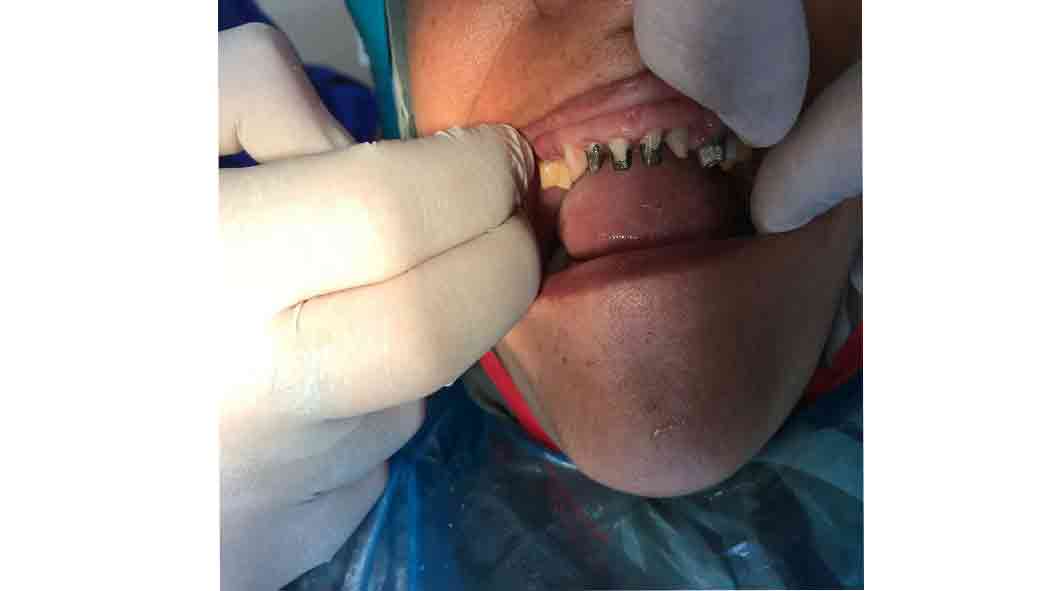 دندانپزشک قزوین-دندانپزشک خوب قزوین-دندانپزشک دکتر یوسف هنردوست