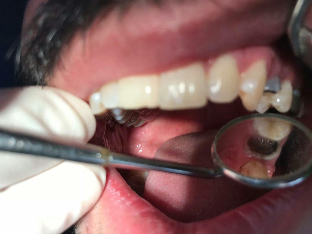 دندانپزشک قزوین-دندانپزشک خوب قزوین-دندانپزشک دکتر یوسف هنردوست