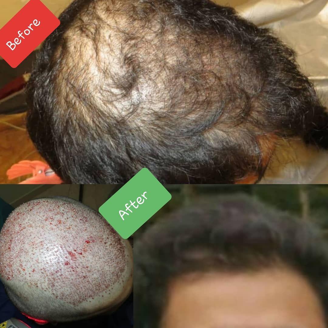 متخصص پوست، مو و زیبایی گرگان دکتر علی مقصودلو