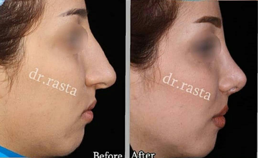 دکتر نسرین راستا جراحی پلاستیک بینی و صورت