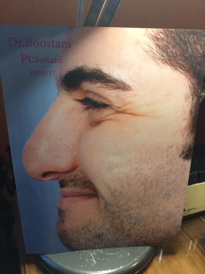دکتر حسین بوستانی متخصص جراحی پلاستیک