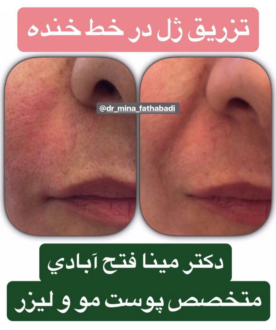 دکتر مینا فتح آبادی متخصص پوست-مو-زیبایی و لیزر