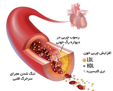 کلسترول بالا چه علائمی به همراه دارد"عوارض" آن را بدانیم